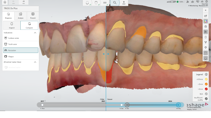 Intraoralscanner